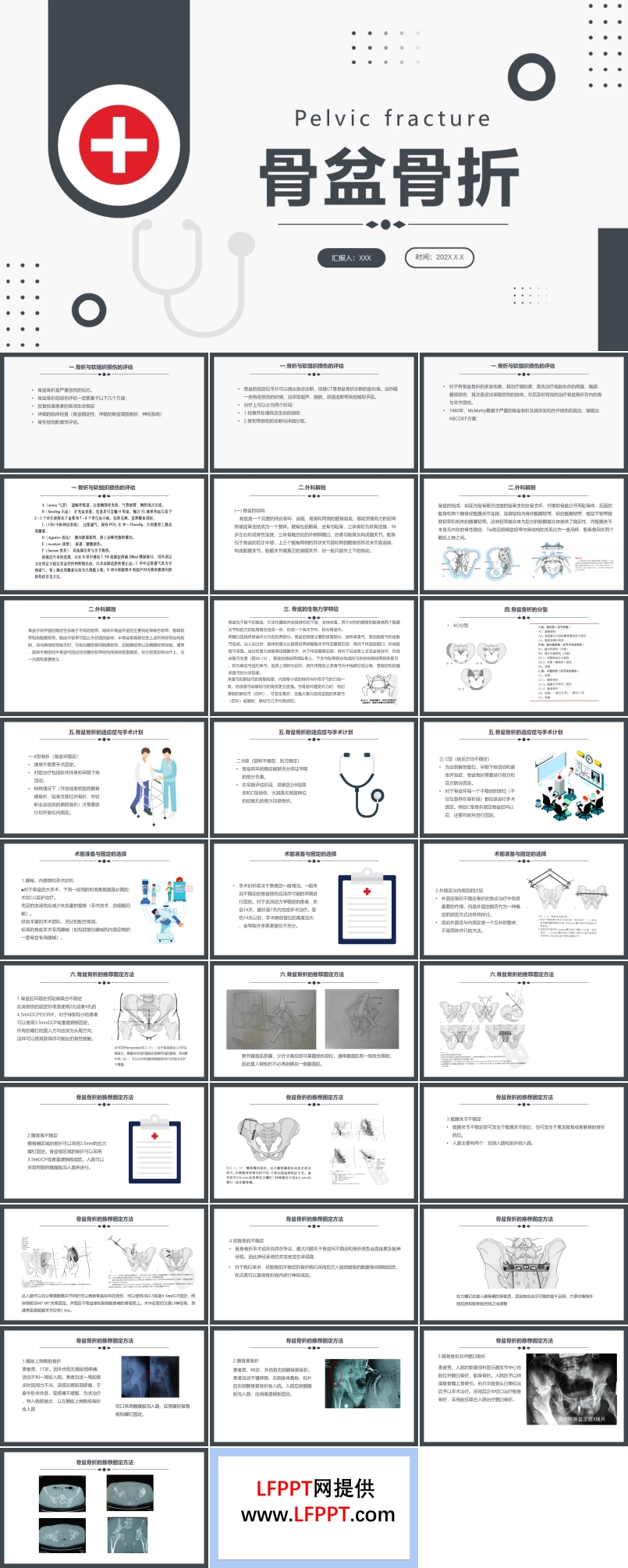 骨盆骨折護(hù)理查房PPT